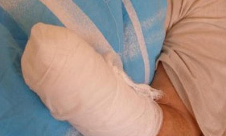 В Воронеже девушке оторвало руку на заводе