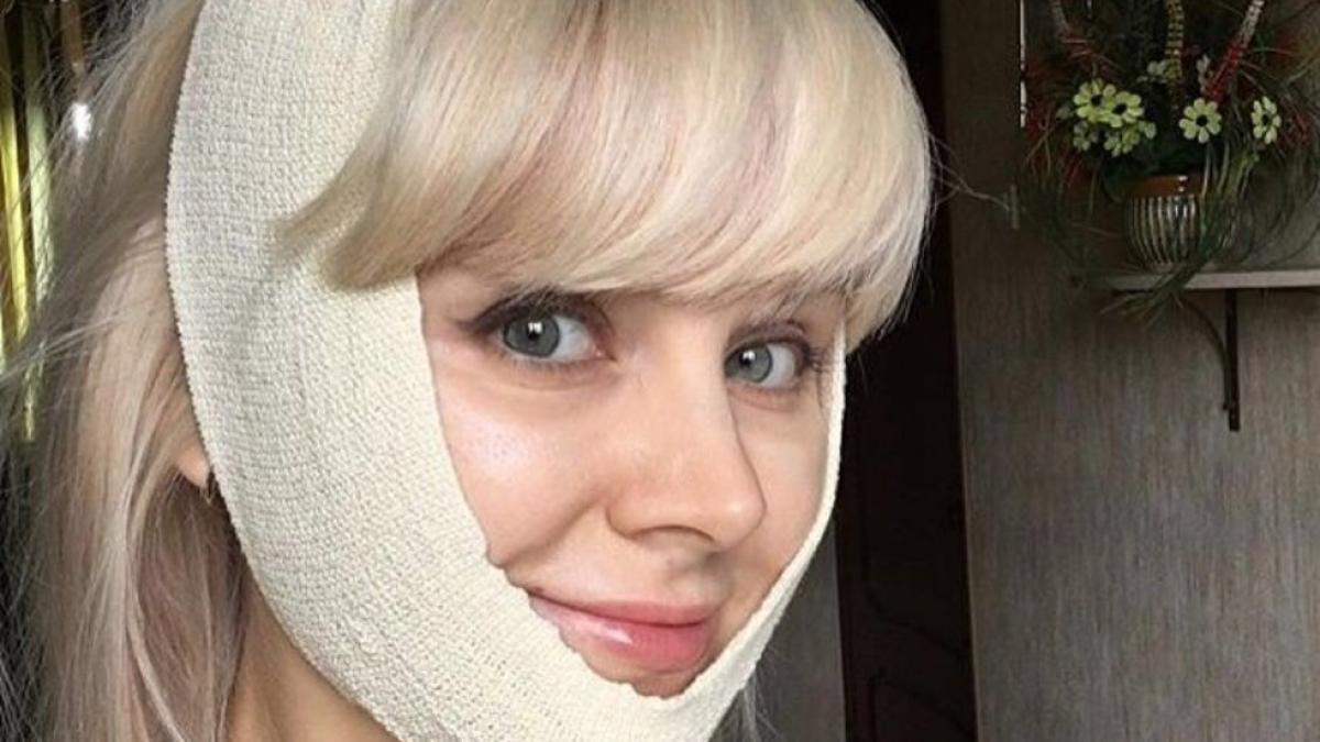 Певица Натали побывала у пластического хирурга Певица Натали побывала у пластического хирурга