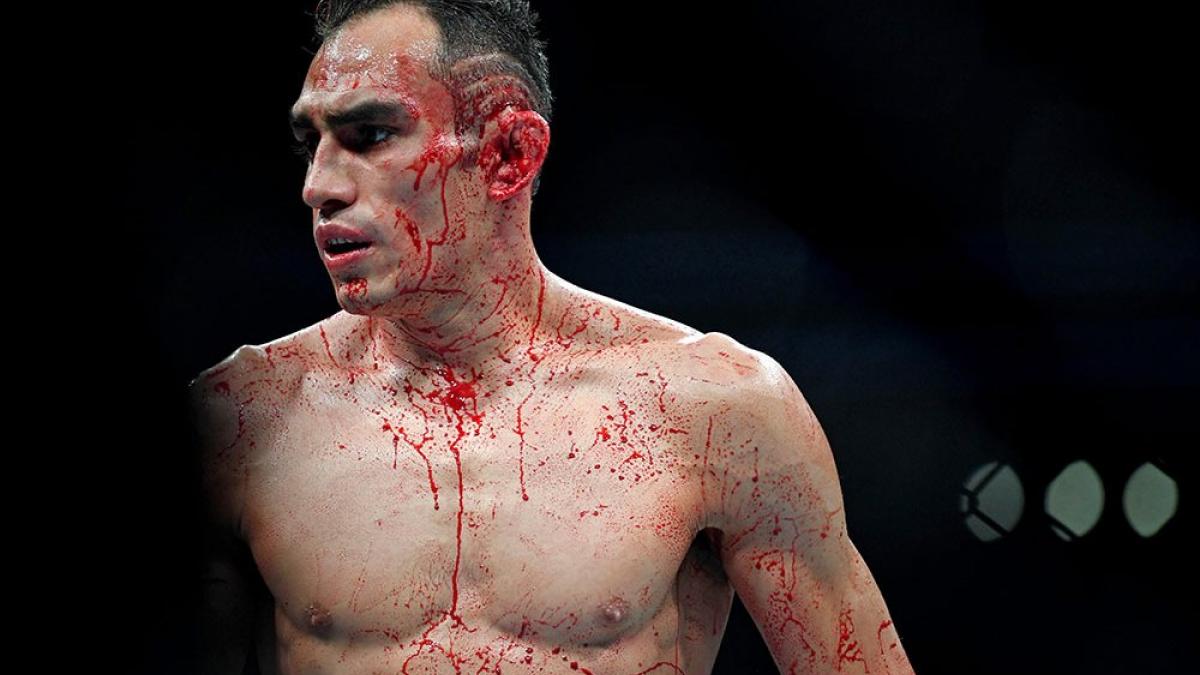 Боец UFC Тони Фергюсон вызван в суд по делу в домашнем насилии - СМИ Боец UFC Тони Фергюсон подозревается в домашнем насилии