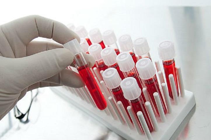 Группа крови влияет на потенцию – ученые 