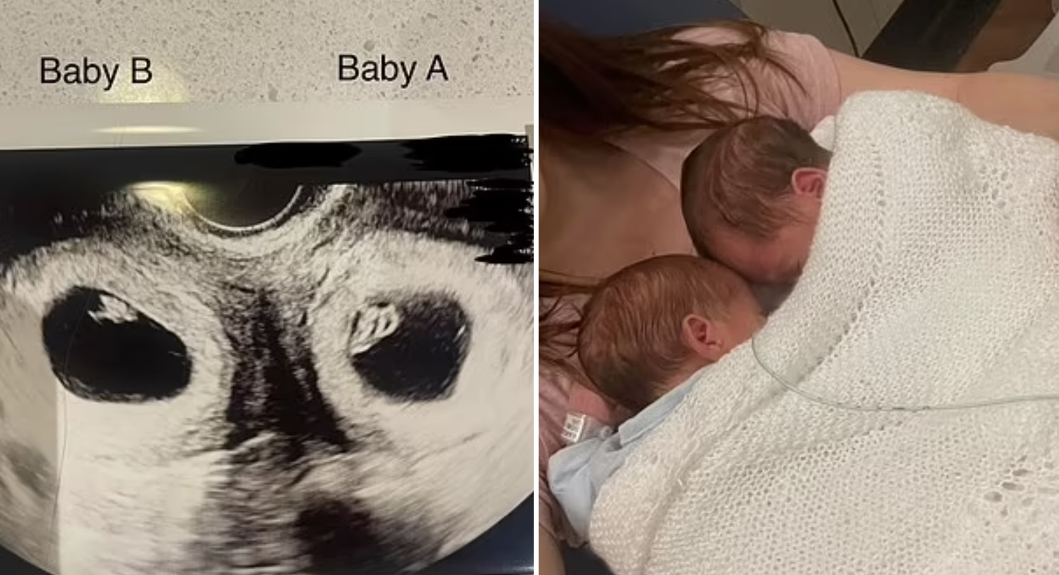 Двойня 24 недели. Женщина родила близнецов. Родила двойню Маныческое. Беременна в 16 родилась двойня.