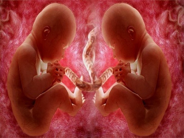 Ребенок в 2 недели съедает. Двойняшки внутриутробно.