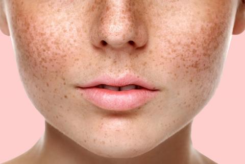 Неприятные последствия весенней косметологии: 5 процедур, от которых стоит оказаться Неприятные последствия весенней косметологии: 5 процедур, от которых стоит оказаться