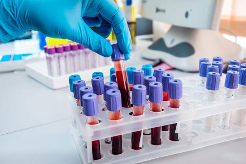 Каждая группа крови притягивает к себе определенные болезни, заявили исследователи
