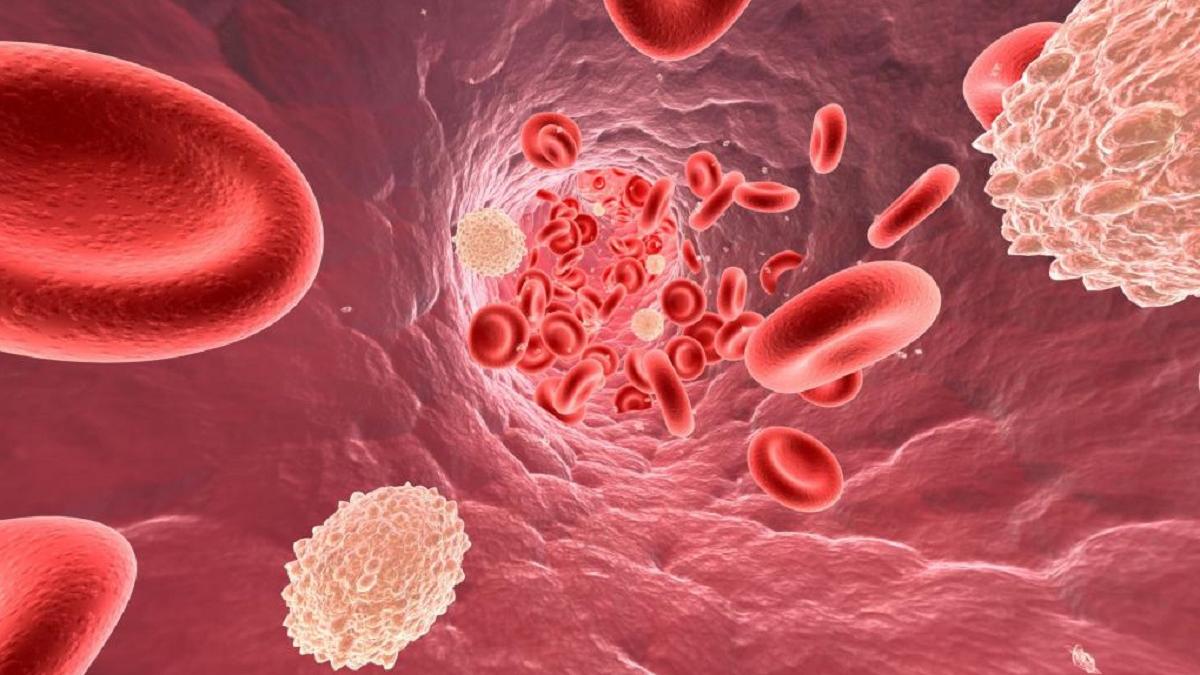 Симптомы повышенного холестерина в организме назвали специалисты Симптомы повышенного холестерина в организме назвали специалисты